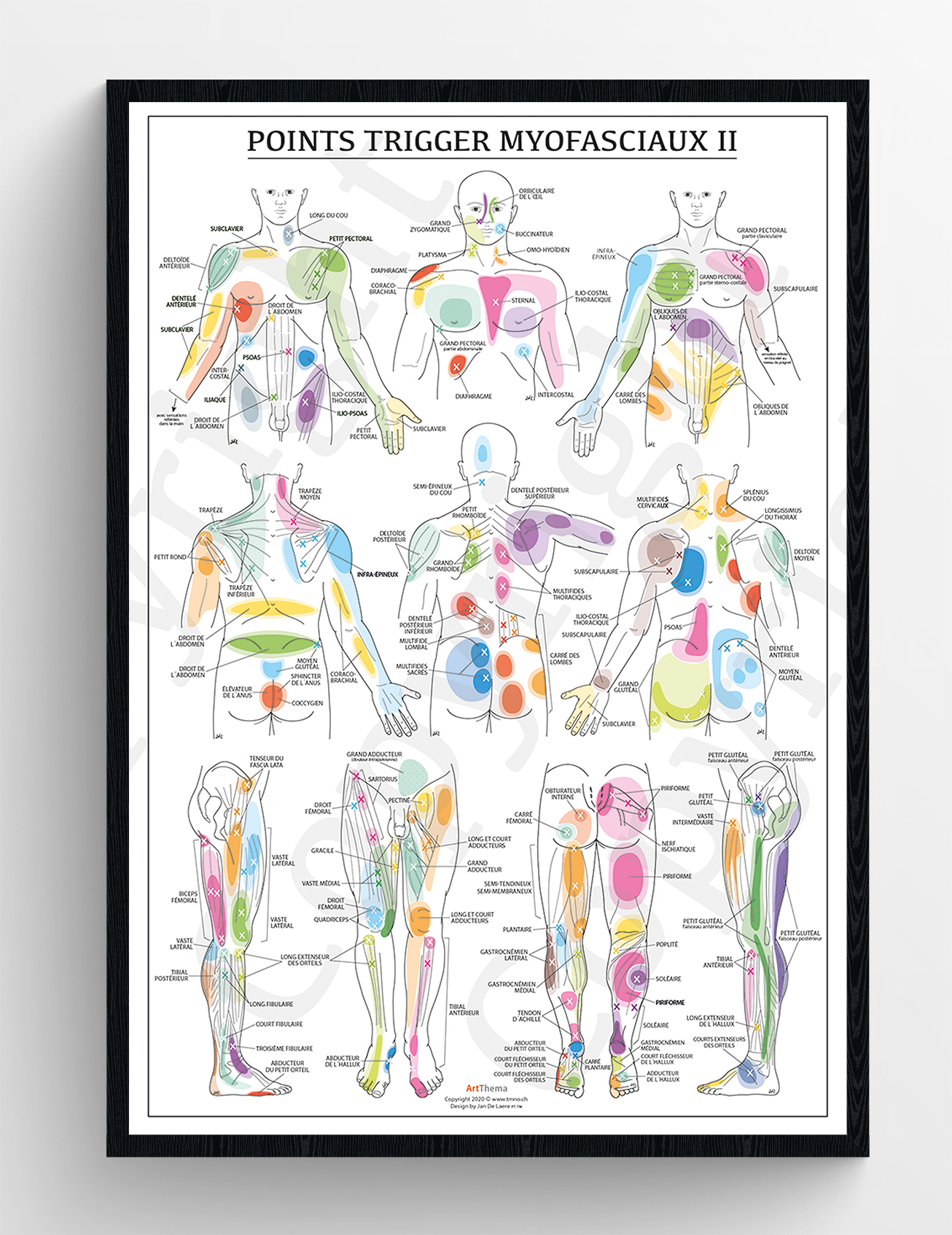 Poster Set Triggerpoints - gelamineerd - 60 x 90 cm