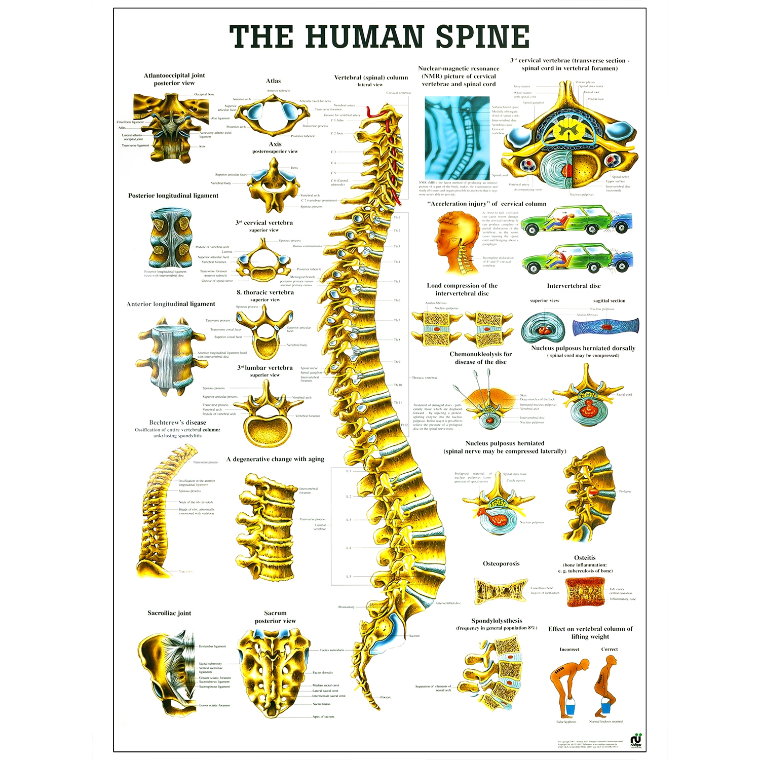 Poster human spine - gelamineerd - 70 x 100 cm