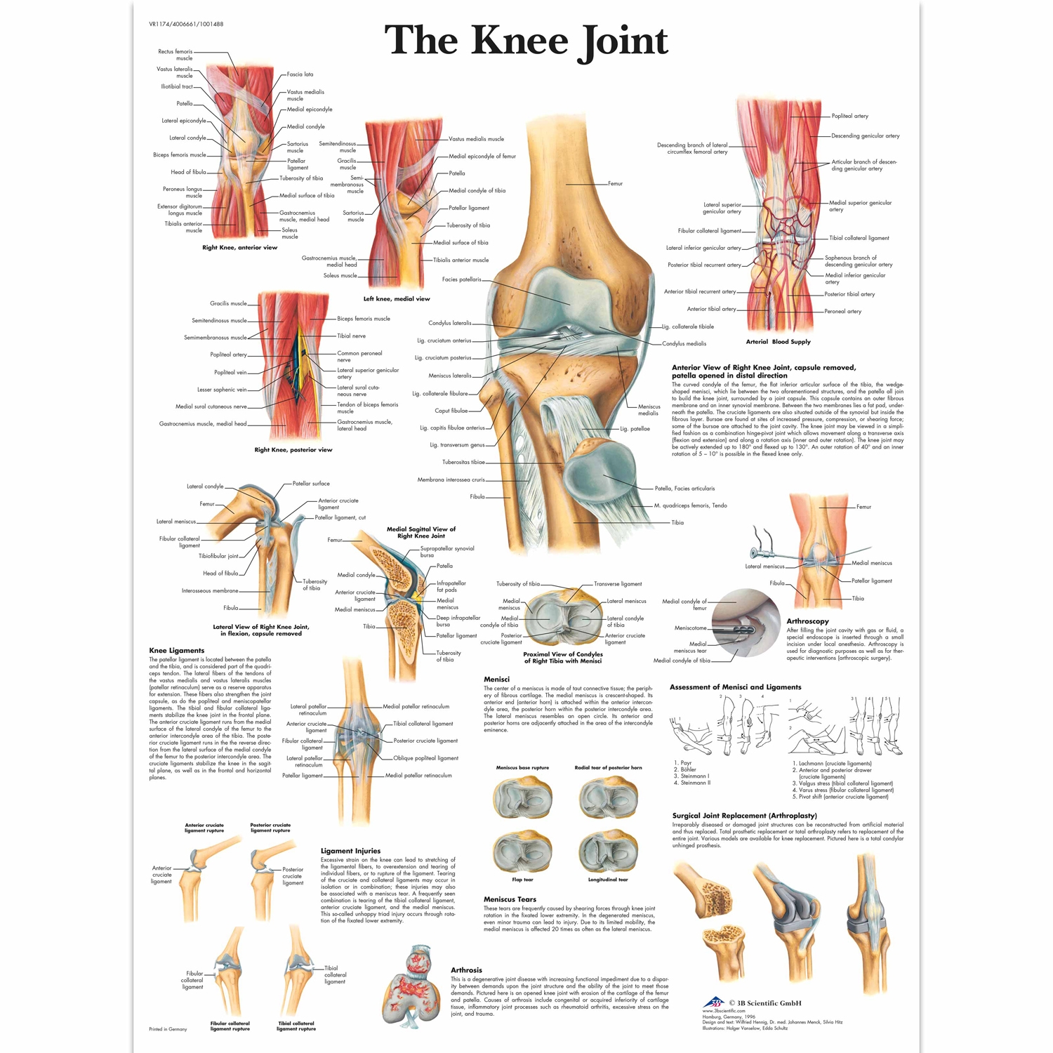 Pancarte murale plastifiée The Knee Joint - 50 x 67 cm