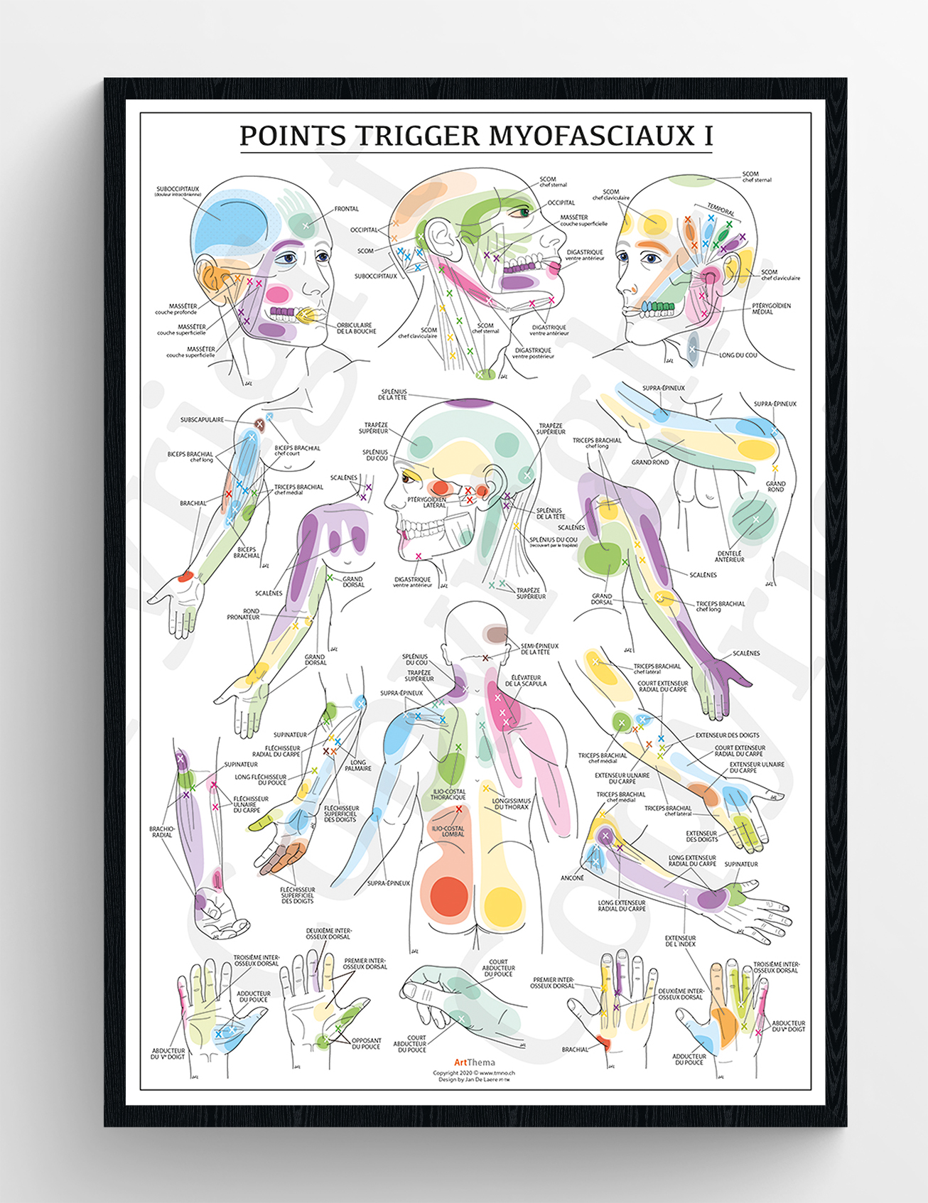 Poster Set Triggerpoints - gelamineerd - 60 x 90 cm
