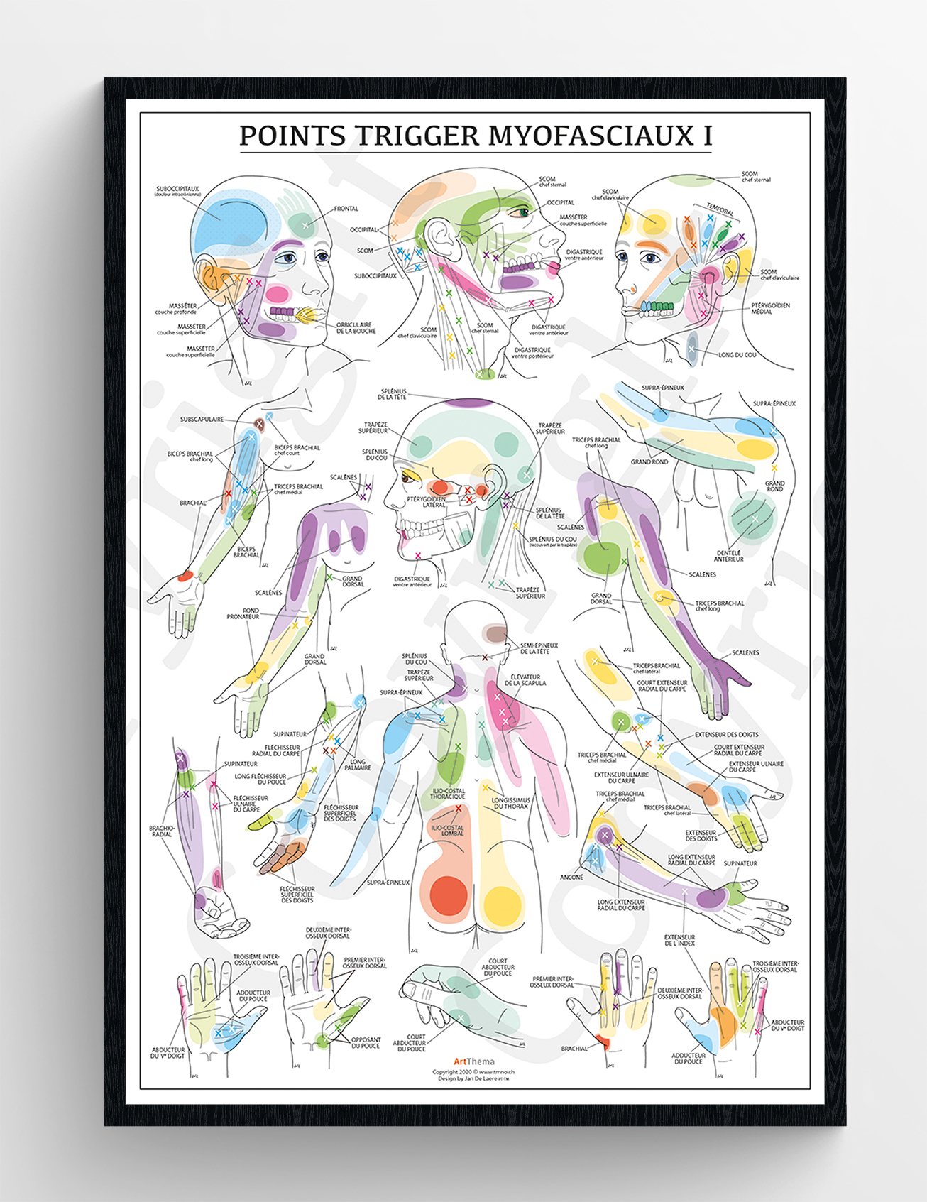 Set de 2 planches Points Trigger - laminé - 60 x 90 cm